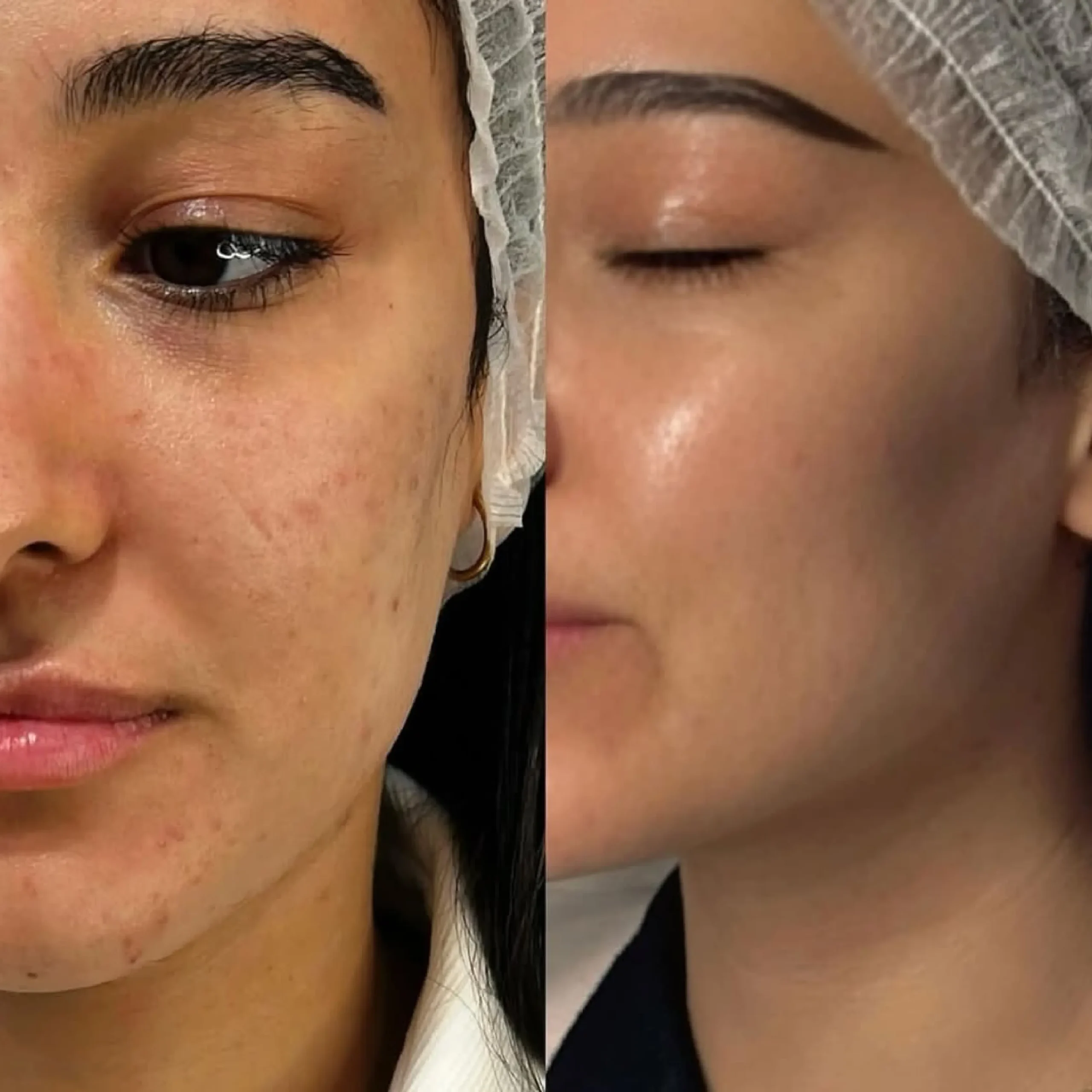 Exosome & Mesotherapy _20250825_091917_٠٠٠٠-19