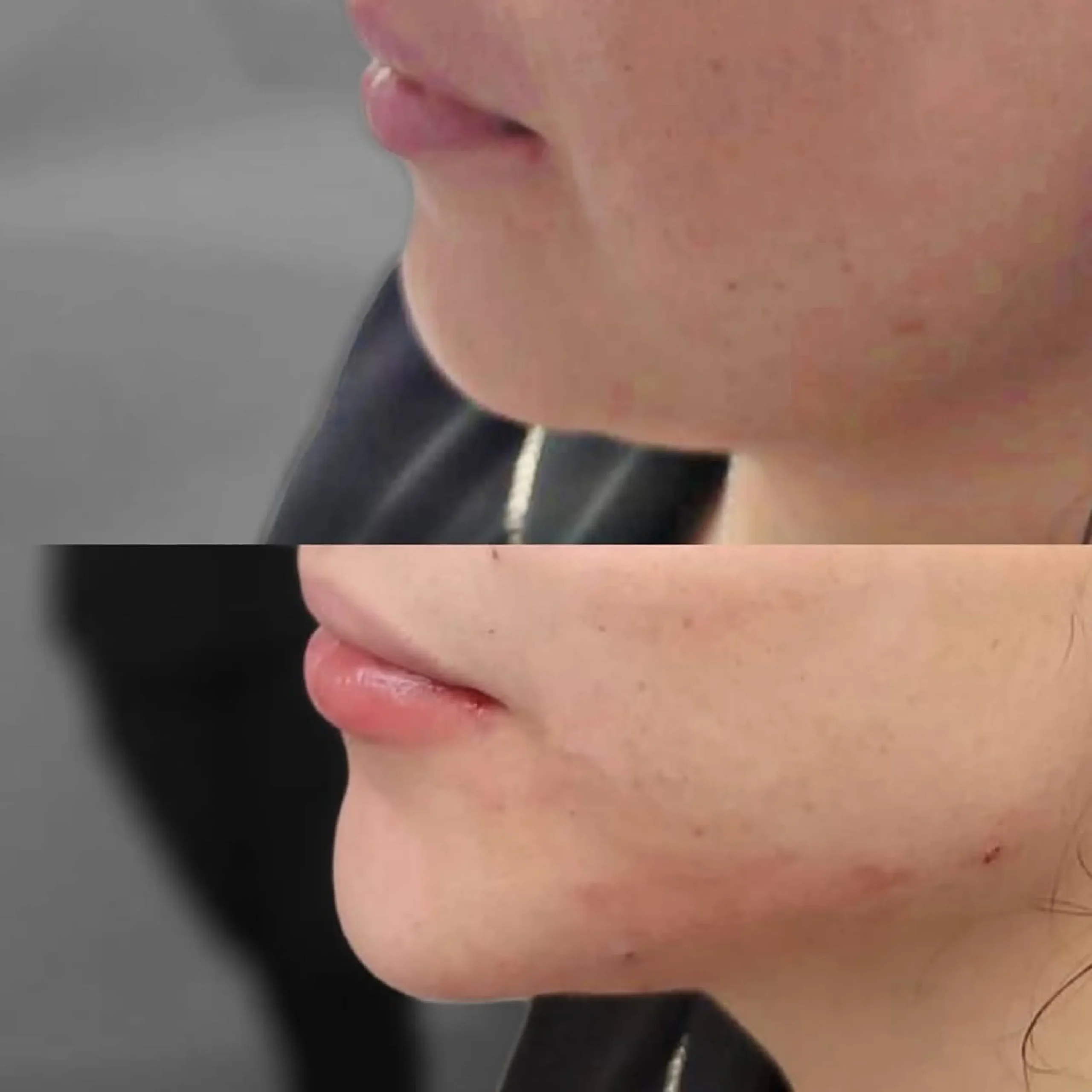 ابر النضارة skin booster _20250825_081841_٠٠٠٠-10