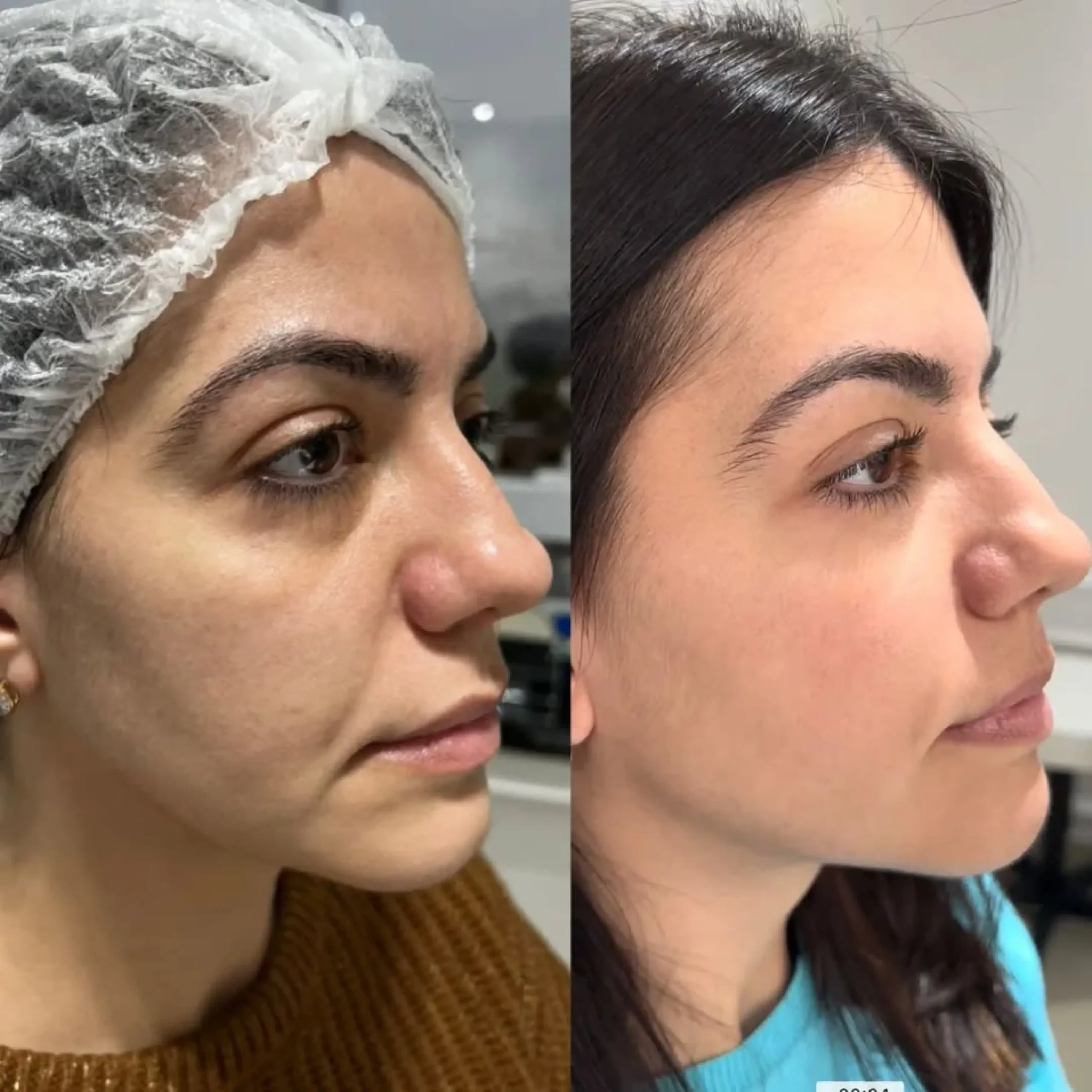 ابر النضارة skin booster _20250825_081841_٠٠٠٠-16