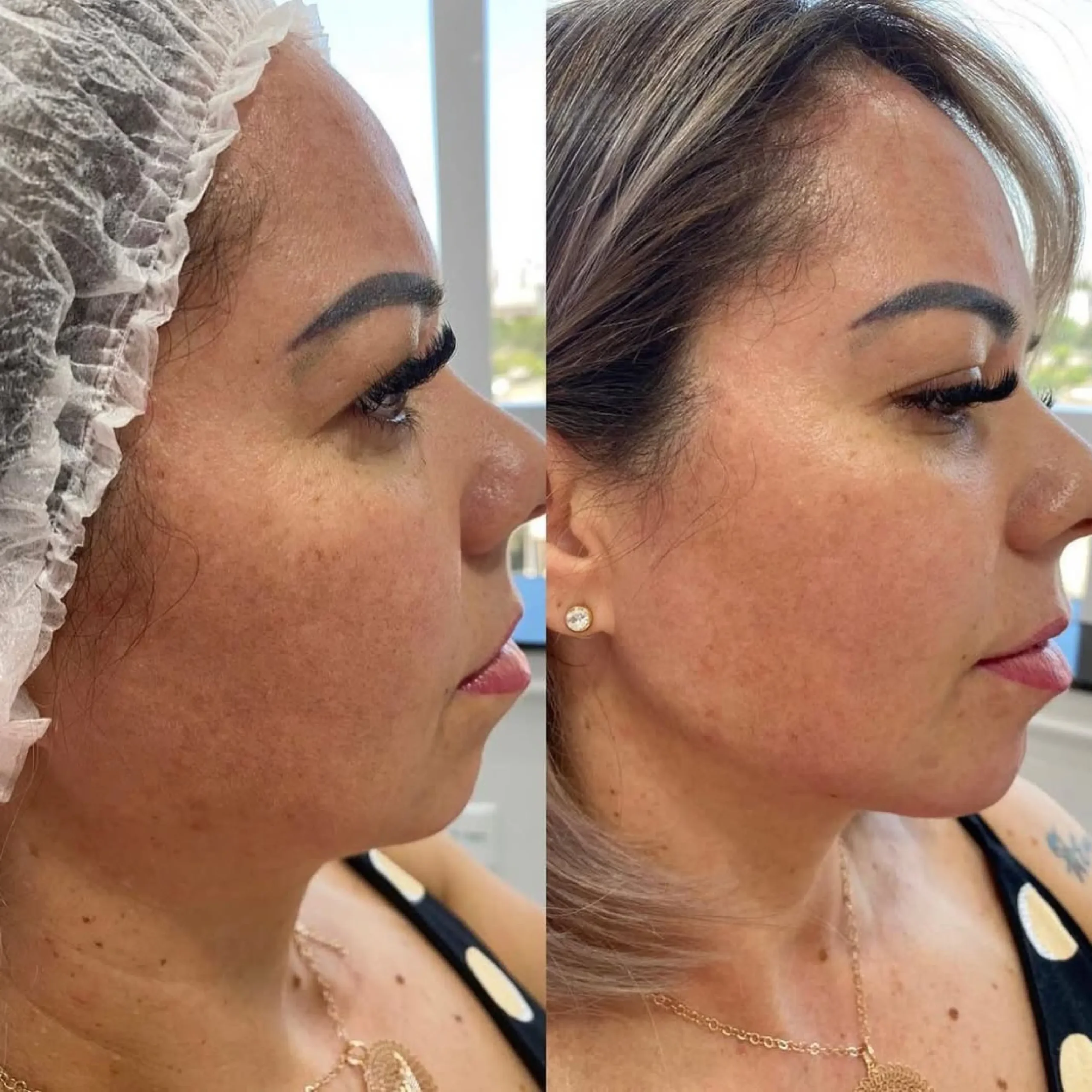 ابر النضارة skin booster _20250825_081841_٠٠٠٠-17