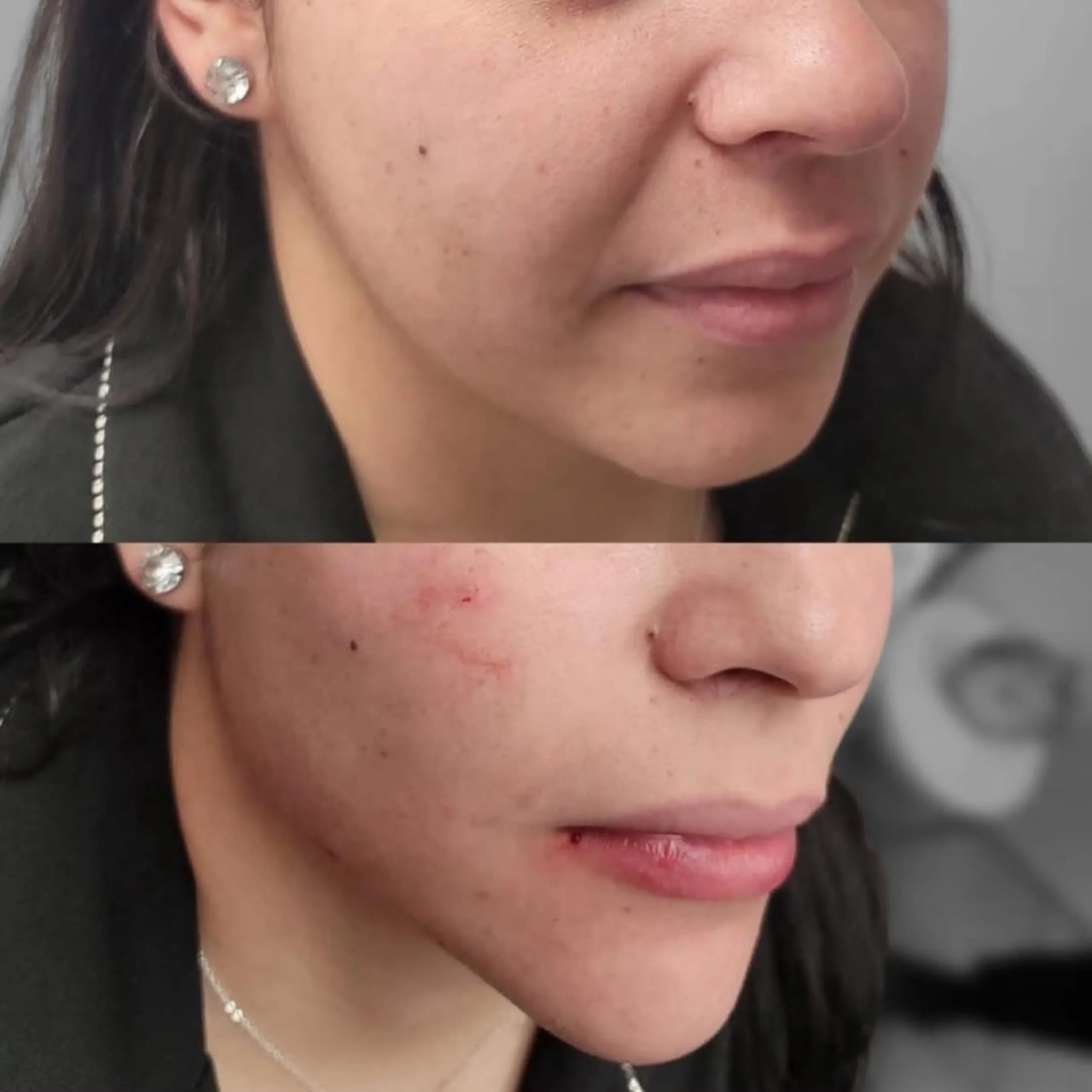 ابر النضارة skin booster _20250825_081841_٠٠٠٠-9